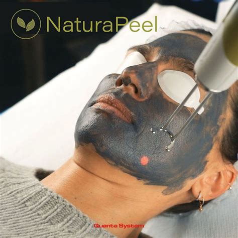 naturapeel laser facial